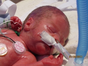 Kaleb William – Born January 21st, 2011 at 23 weeks. 